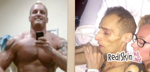 Бодибилдер Дин Вормби умер от рака, вызванного стероидами из-за нескольких лет злоупотребления