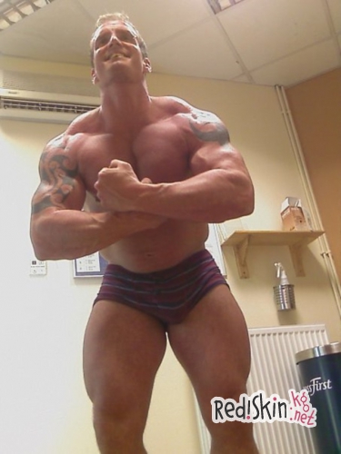 Бодибилдер Дин Вормби умер от рака, вызванного стероидами из-за нескольких лет злоупотребления