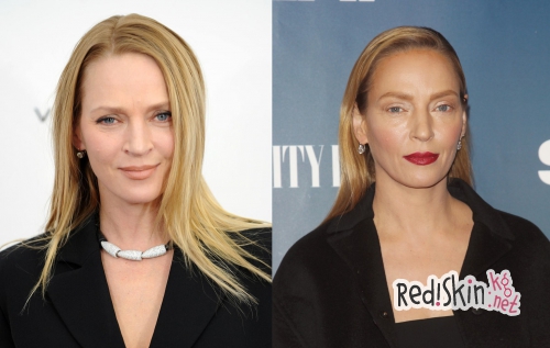 Знаменитости, утратившие свою красоту из-за пластики