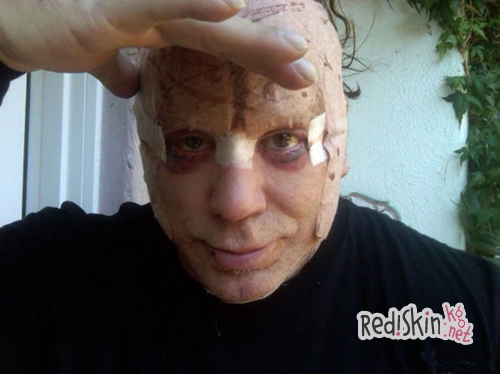 Знаменитости, утратившие свою красоту из-за пластики