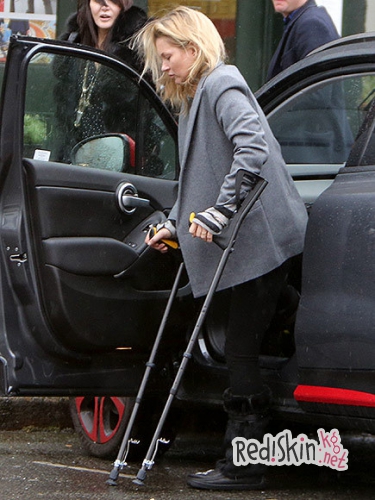 Кейт Мосс получила серьезную травму ноги