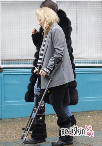 Кейт Мосс получила серьезную травму ноги