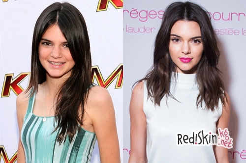 Врач косметолог-дерматолог Табасум Мир утверждает, что внешний вид Ким Кардашян не заслуга спорта и диеты, а работа профессиональных пластических хирургов