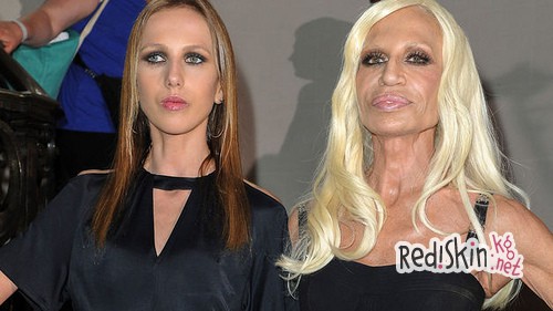 Больная анорексией Аллегра Версаче идет на поправку