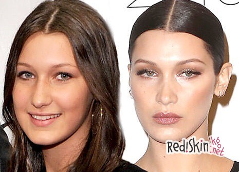 Известную модель Беллу Хадид обвиняют в пластике лица