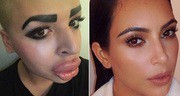 Одержимый пластической хирургией и семейством Кардашьян-Дженнер: 24-летний Джордан сделал нос как у Ким, а подбородок как у Кайли (видео)