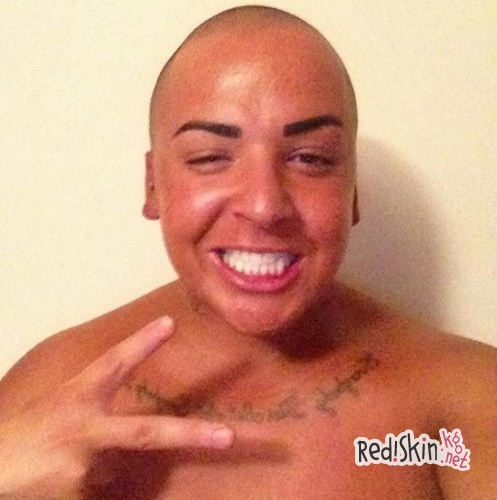 Одержимый пластической хирургией и семейством Кардашьян-Дженнер: 24-летний Джордан сделал нос как у Ким, а подбородок как у Кайли (видео)