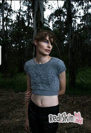 Гермафродит, который пытался покончить жизнь самоубийством 6 раз, стал моделью, чтобы накопить денег на операцию по коррекции пола