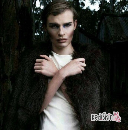 Гермафродит, который пытался покончить жизнь самоубийством 6 раз, стал моделью, чтобы накопить денег на операцию по коррекции пола