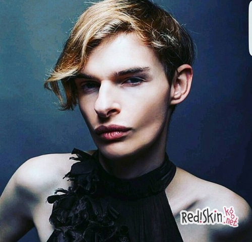 Гермафродит, который пытался покончить жизнь самоубийством 6 раз, стал моделью, чтобы накопить денег на операцию по коррекции пола