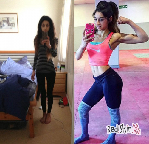 Похудеть до смерти: 25-летняя девушка из Шотландии рассказала как победила анорексию и стала фитнес-моделью